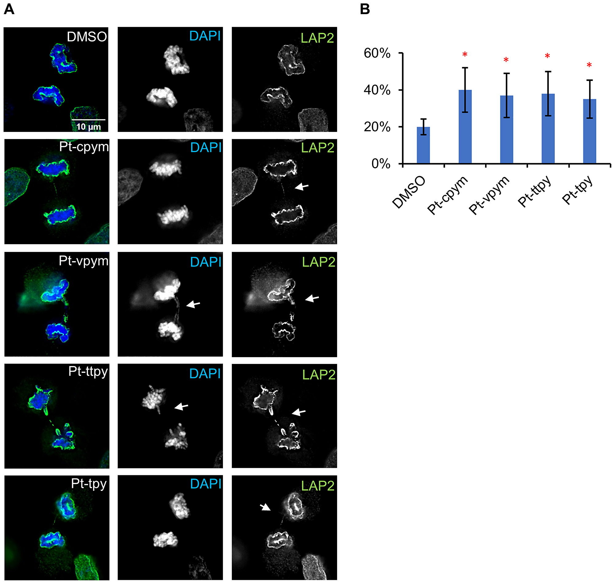 Chromatin bridge formation in HT1080 cells after treatment by Pt-tpy and its three derivatives, Pt-cpym, Pt-vpym and Pt-ttpy at telophase/cytokinesis.