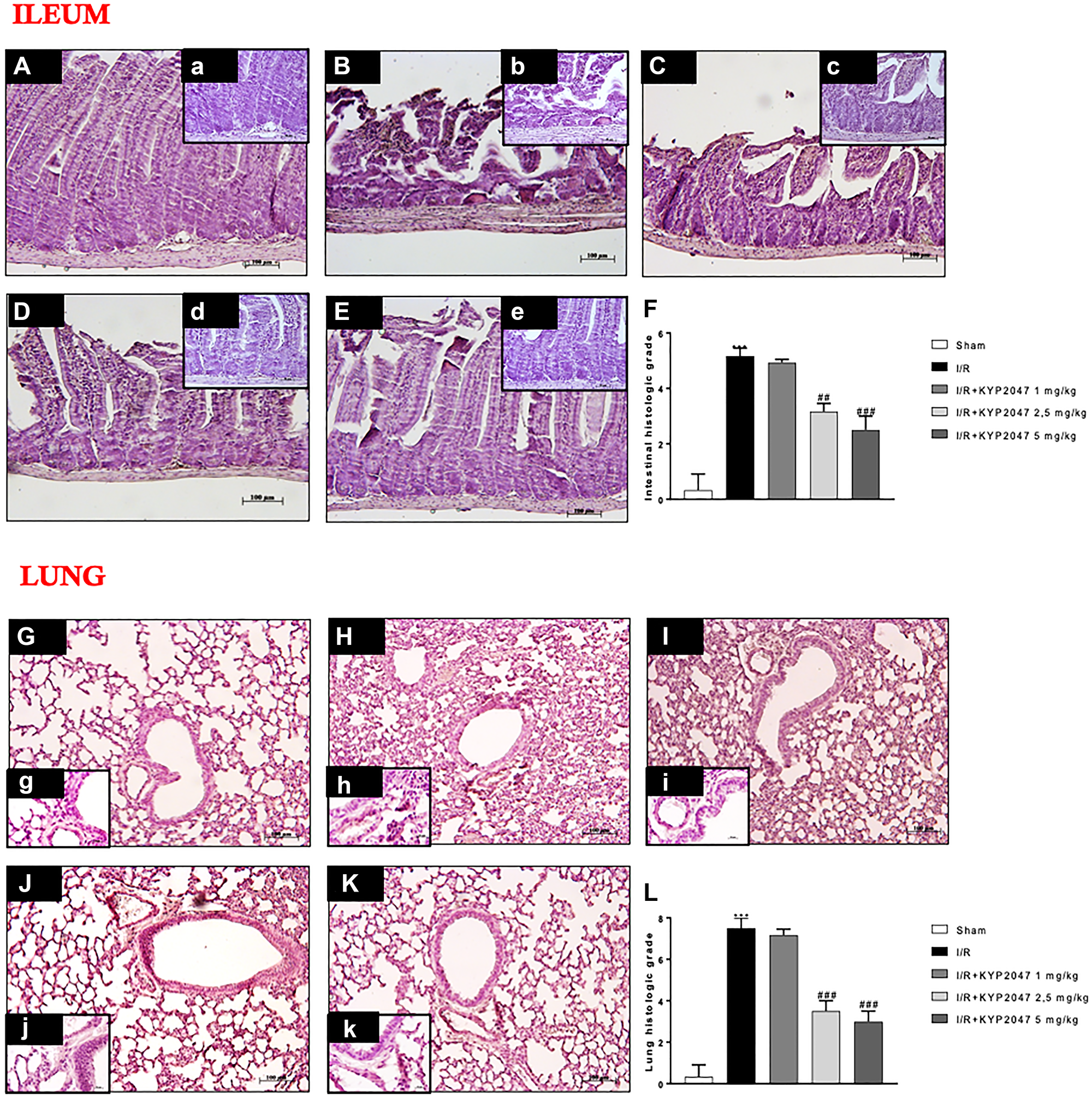 Role of KYP-2047 treatment on histological lung damage induced by II/R.