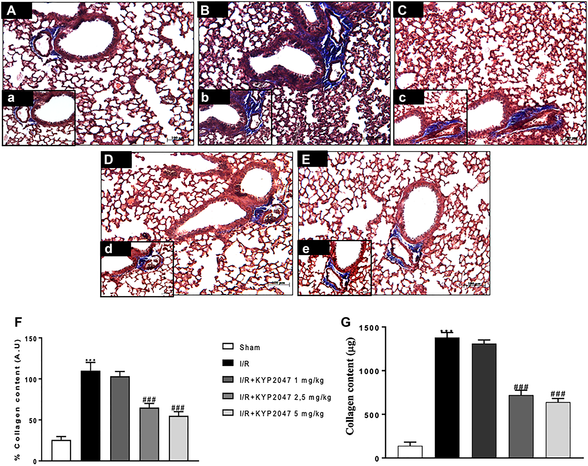 Role of KYP-2047 treatment on the collagen content.