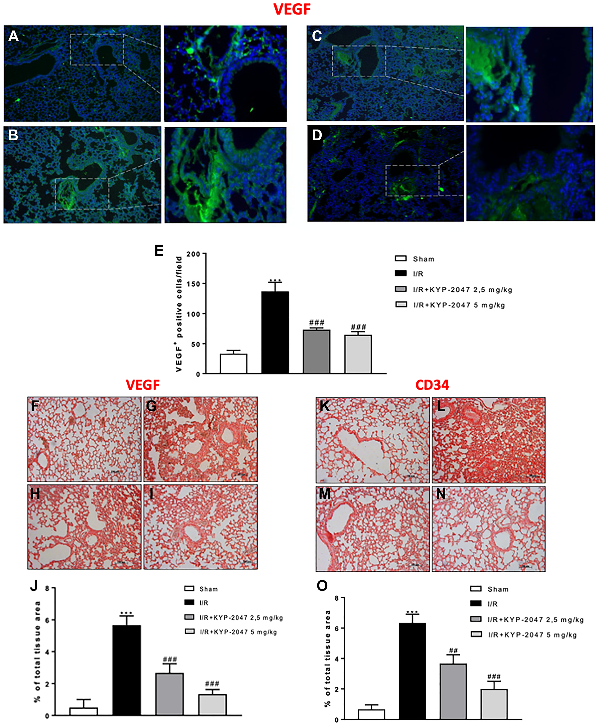 KYP-2047 treatment on angiogenesis.