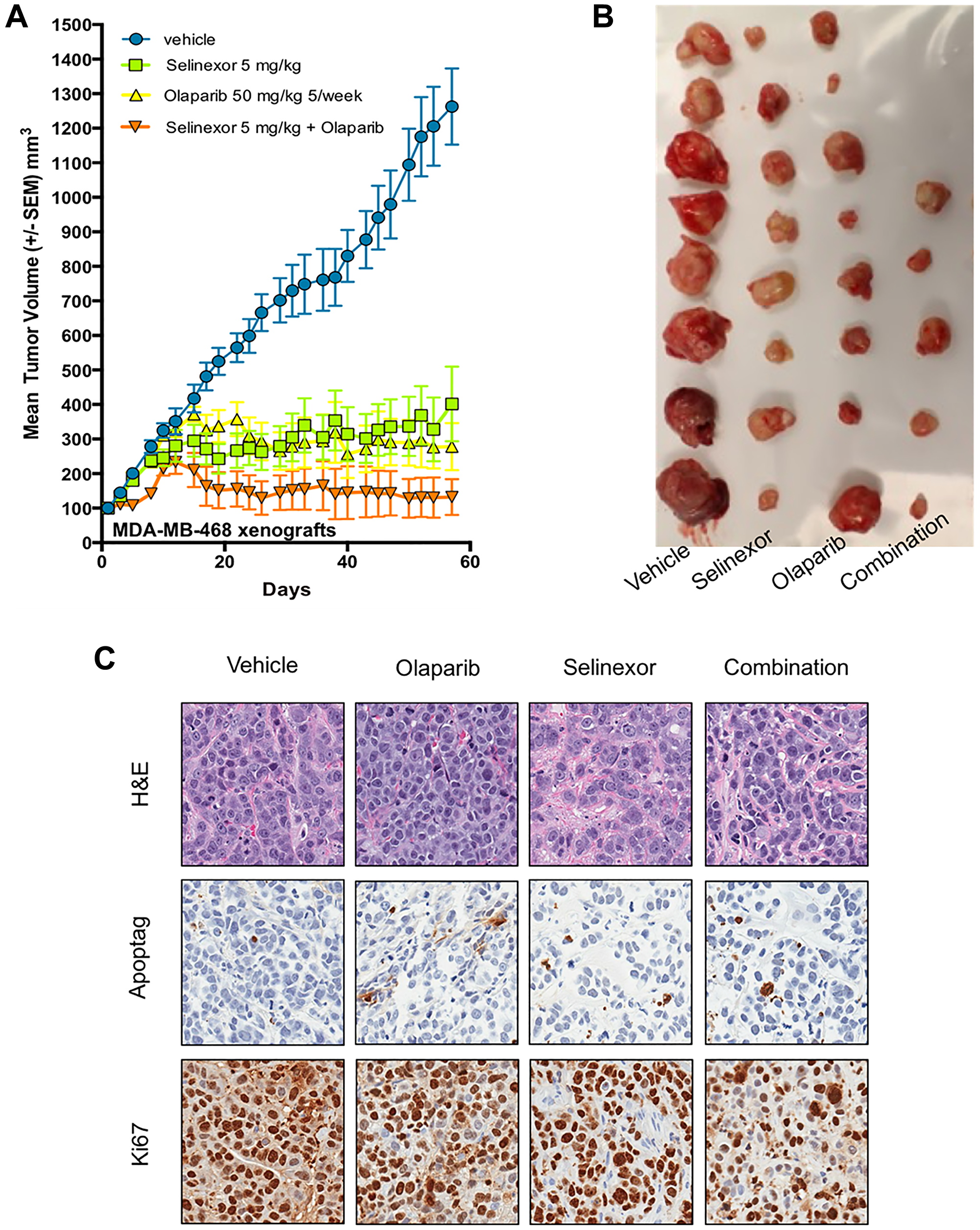 Synergistic effect of olaparib and selinexor on the growth of BRCA1-wt MDA-MB-468, xenografts in immunodeficient mice.