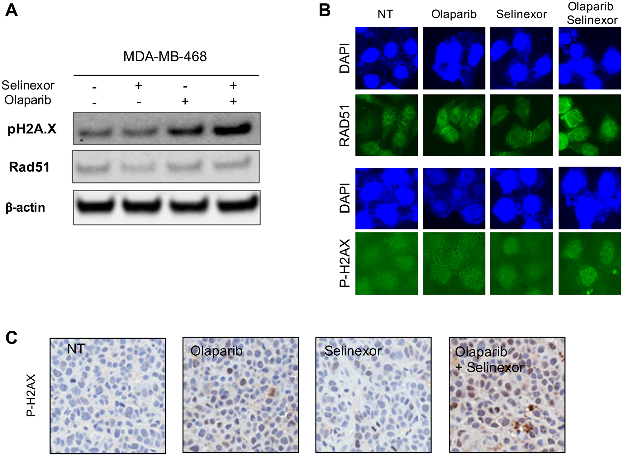 Effects of treatment with olaparib and selinexor (alone and in combination) on the homologous recombination pathway in MDA-MB-468 (BRCA1-wt TNBC cell).