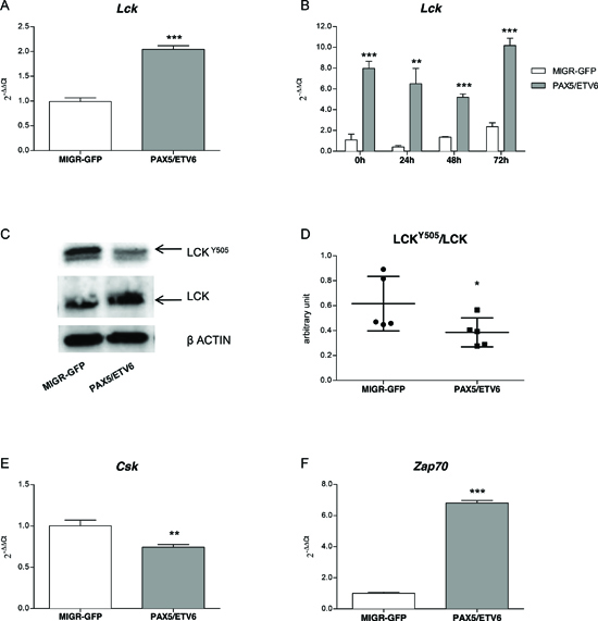 PAX5/ETV6 fusion protein leads to Lck over-activation.