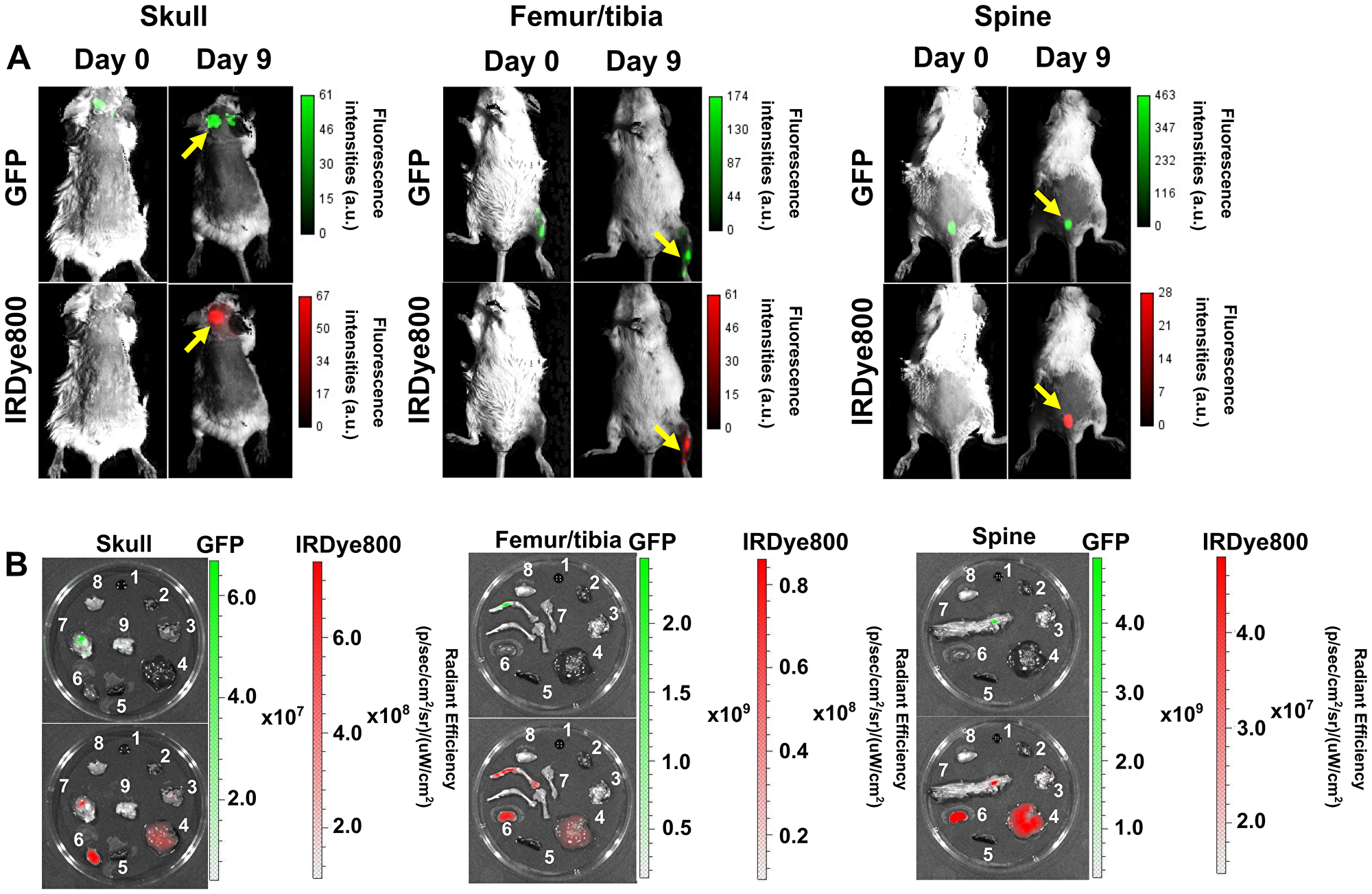 Specific binding of DARA-DM1-IR to cancerous bone marrow regions in MM.1S IV mice.