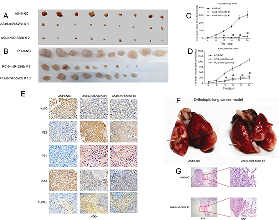 Hsa-miR-526b inhibits xenografts and orthotopic lung cancer growth in nude mice.