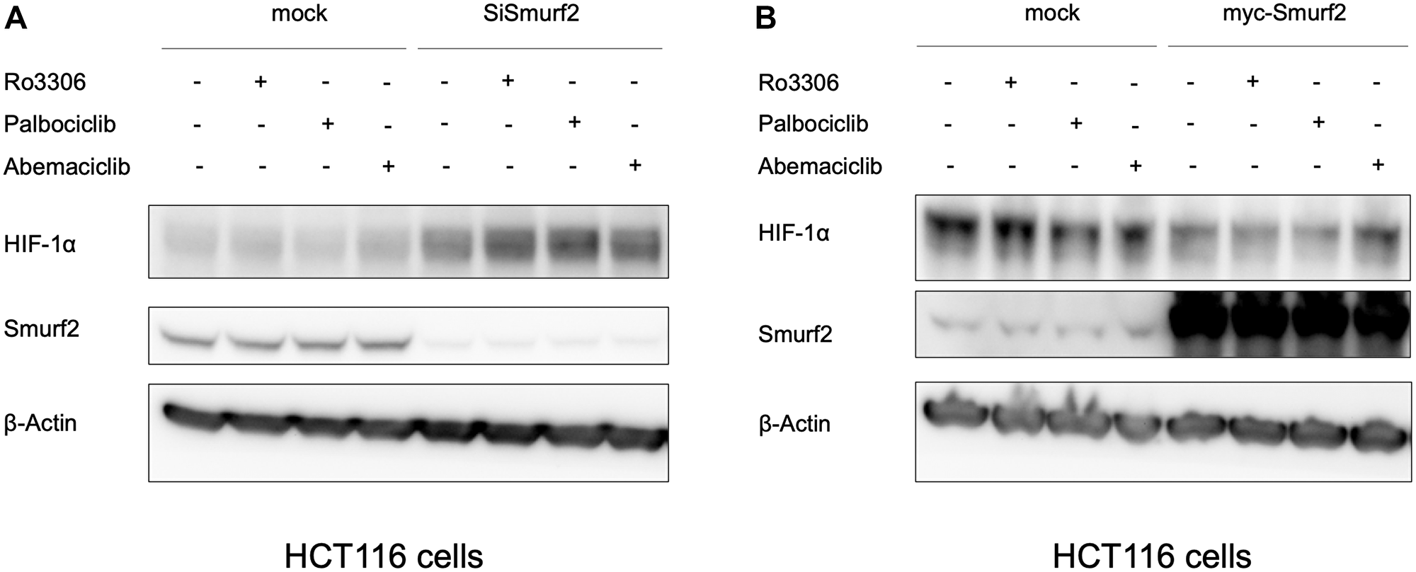 Smurf2 regulates HIF-1α expression in HCT116 colon cancer cells.