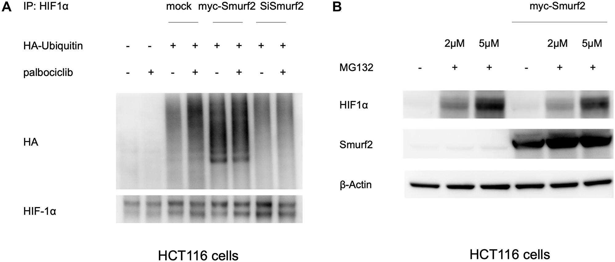 Smurf2 enhances HIF1α ubiquitination in normoxia.