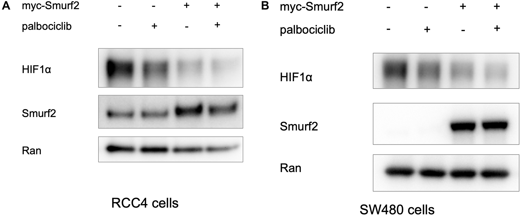 Overexpression of Smurf2 reduces HIF-1α expression level in RCC4 cells under normoxia and in SW480 cells under hypoxia.