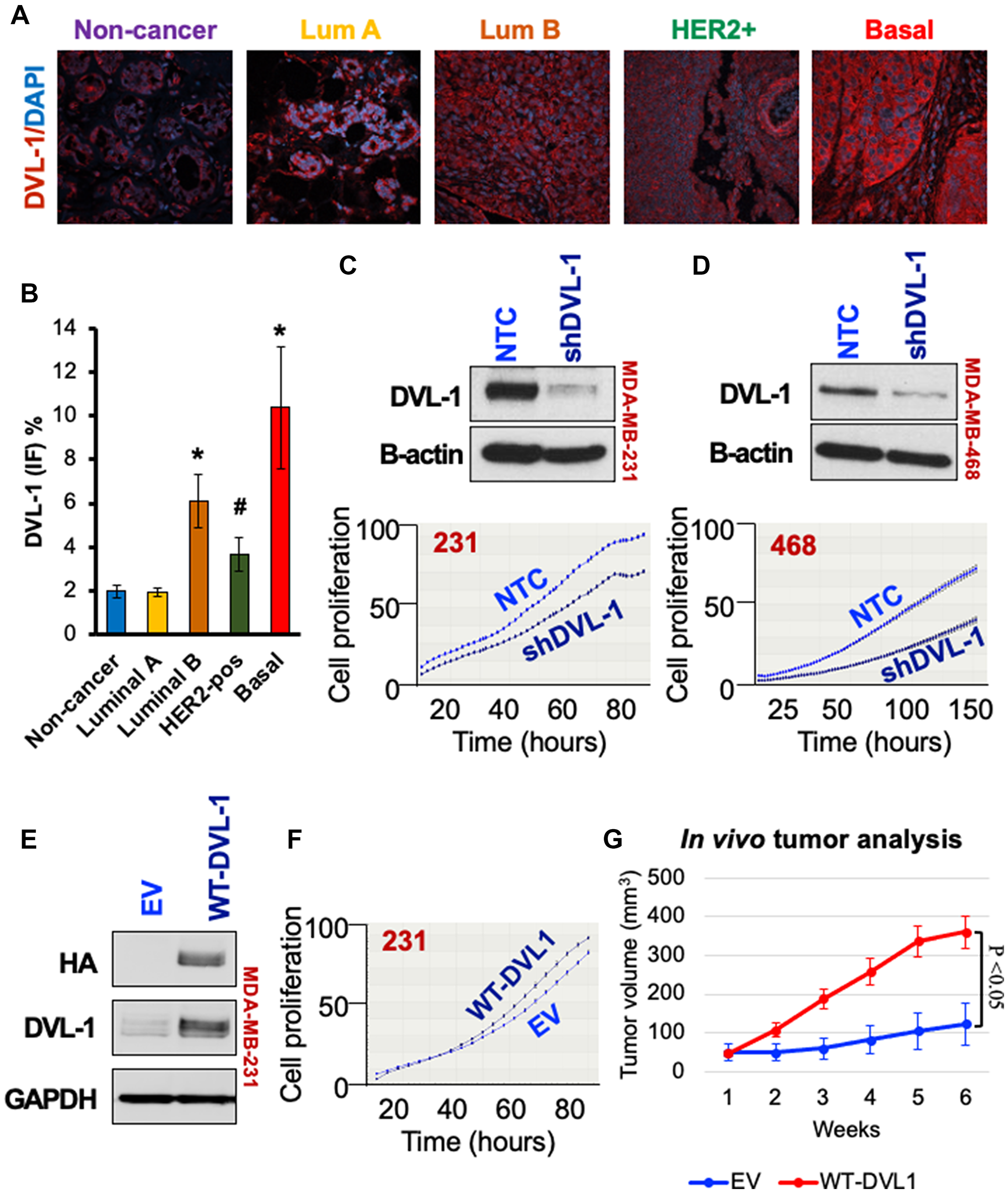 High DVL-1 expression promotes cell proliferation and xenograft tumor growth in triple-negative breast cancer.