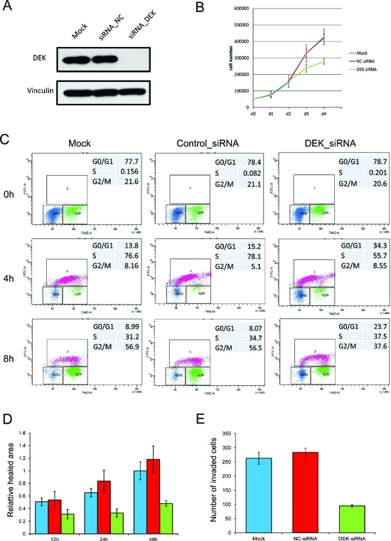 Knockdown of DEK suppresses PC-3 cell growth, migration and invasion.