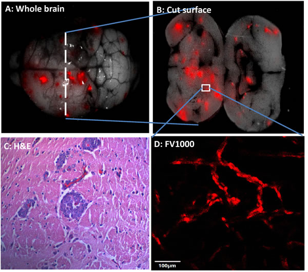 Brain metastasis after cardiac ventrical injection of high brain-metastatic variants.