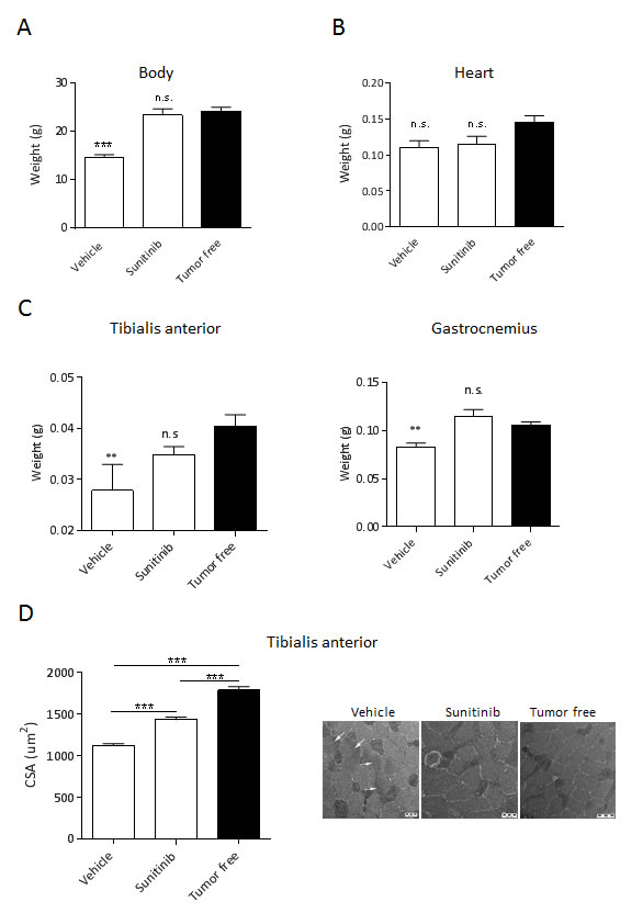 Sunitinib prevents RXF393-induced skeletal muscle wasting.