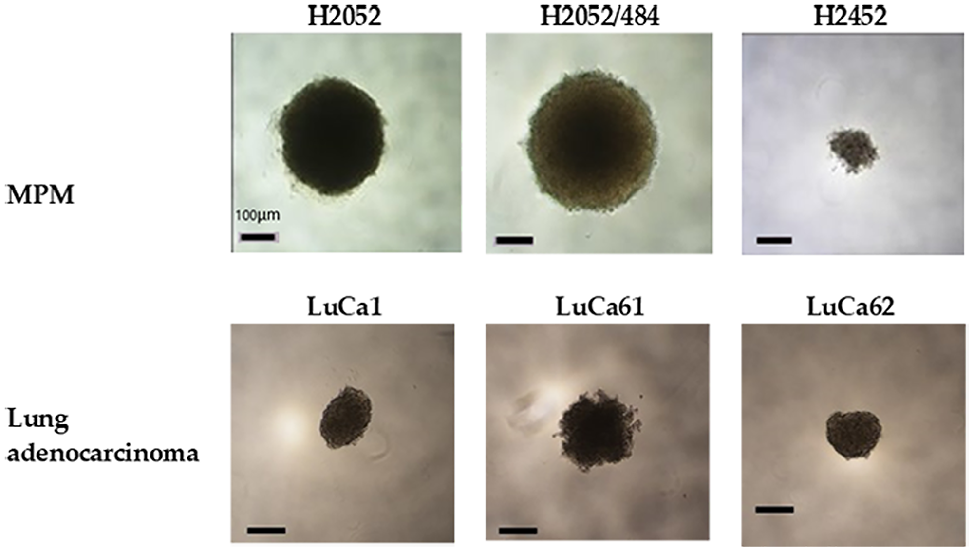 Multicellular spheroids were generated from MPM and lung adenocarcinoma cell populations.