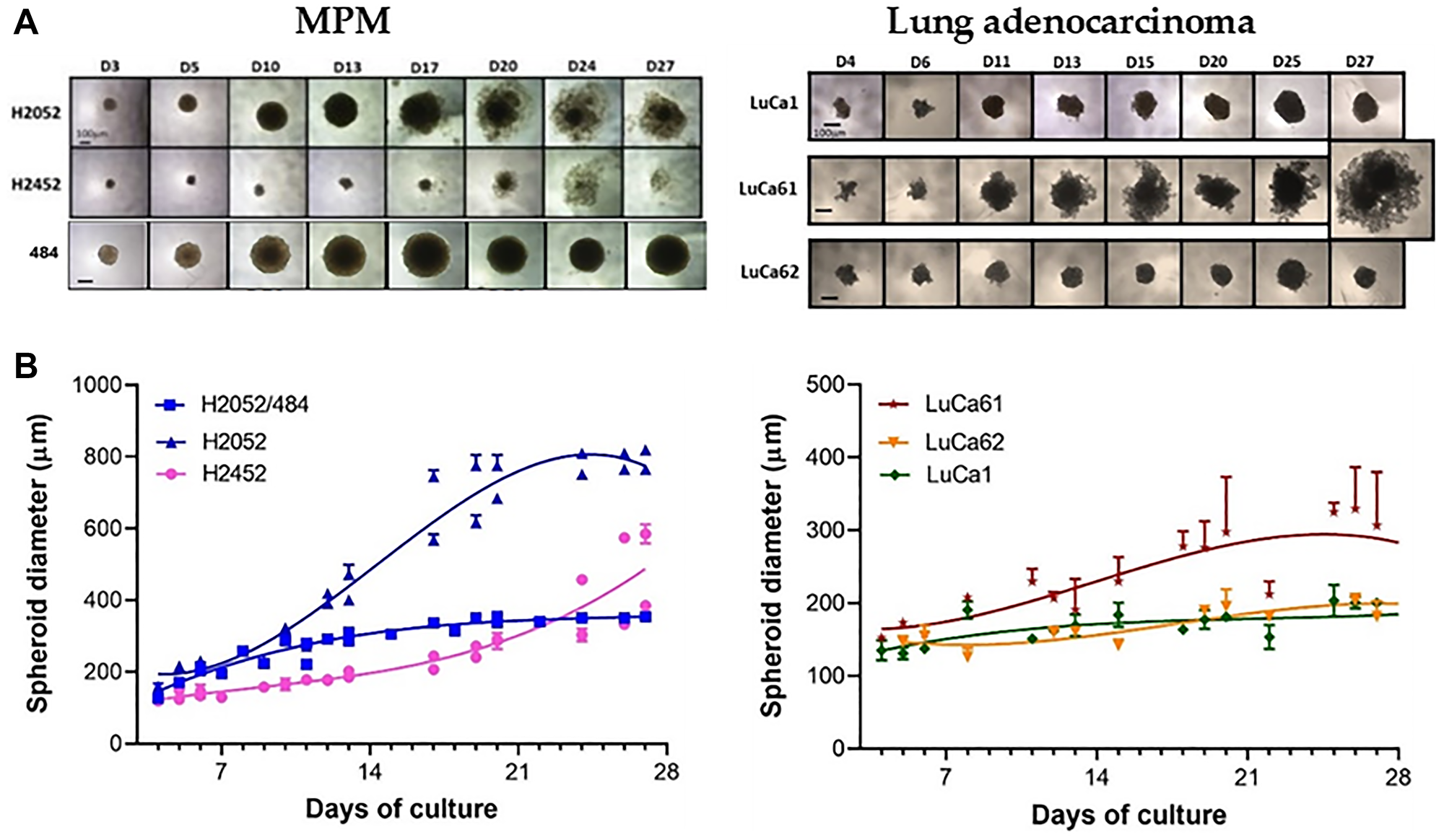 MPM and lung adenocarcinoma spheroid growth kinetic.