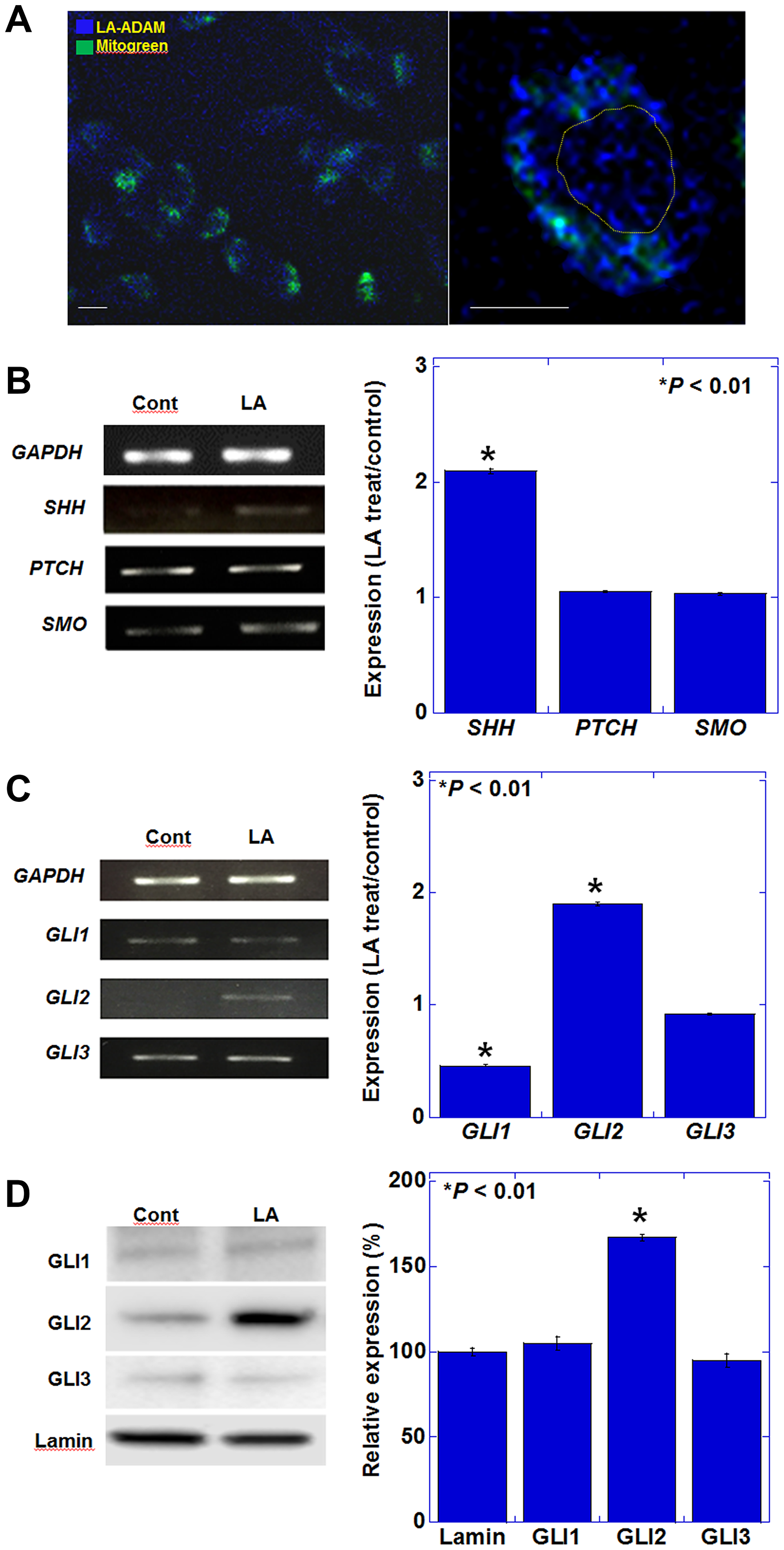 Effect of LA on the expression of genes encoding SHH pathway mediators in CT26 cells.