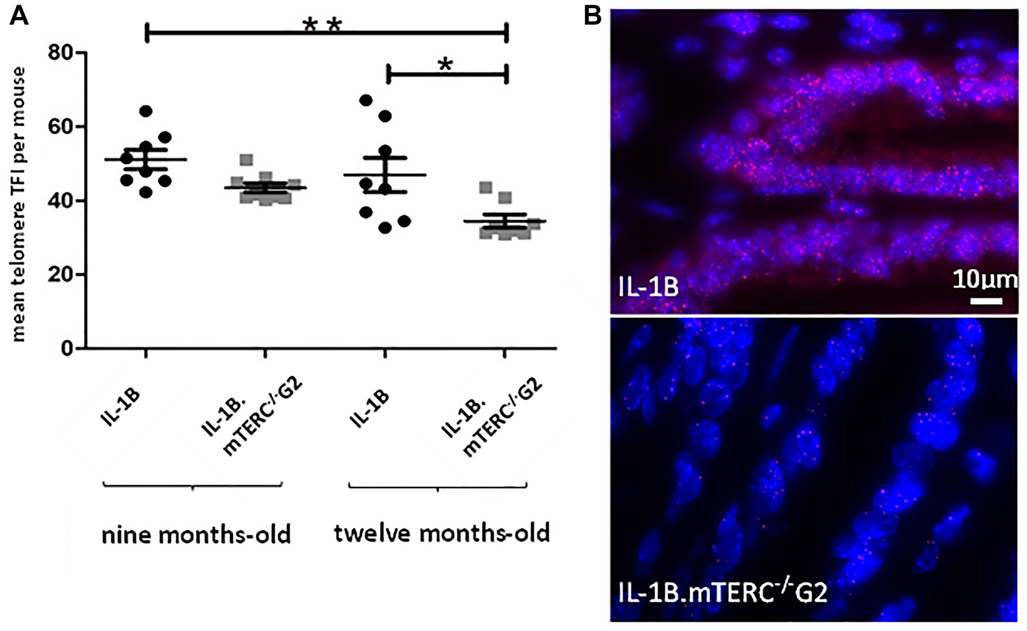 Murine telomere analysis.