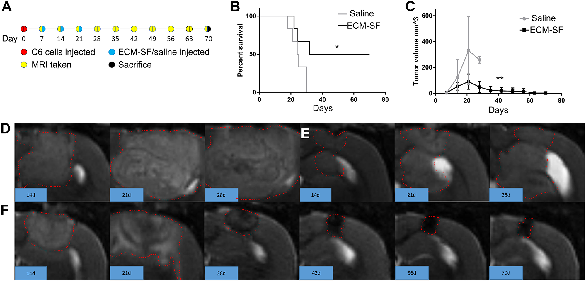 Pre-clinical model of treatment of glioblastoma with ECM-SF.