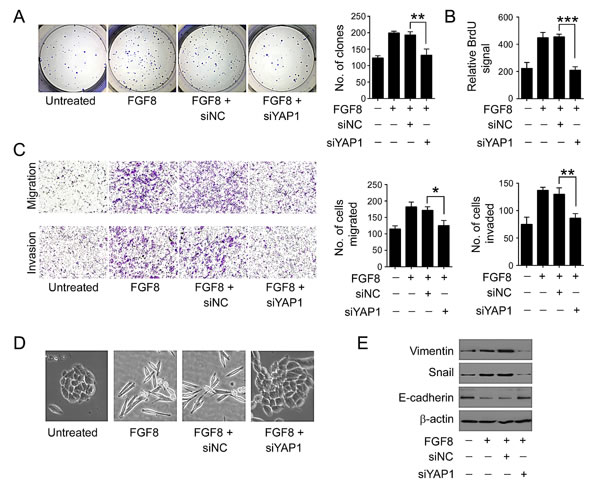 YAP1 is essential for FGF8-mediated tumor growth and metastasis.