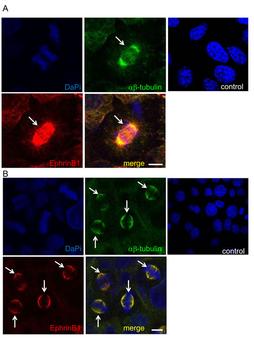 EphrinB1 co-localizes with alpha and beta tubulin.