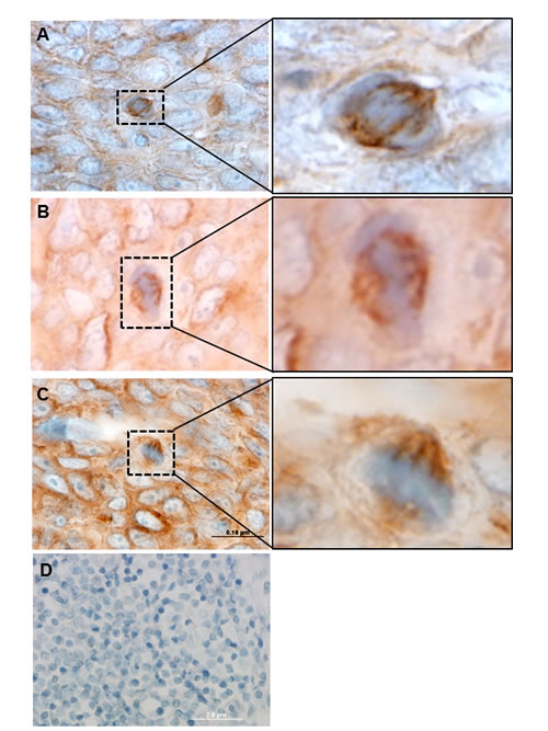 EphrinB1 labels mitotic figures in human tumor.