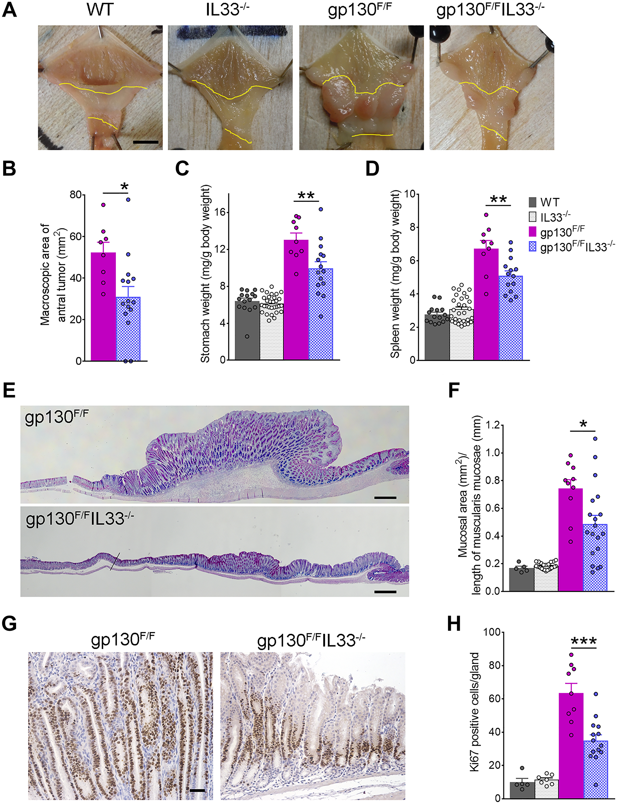 Gastric tumorigenesis in gp130F/F and gp130F/FIL33−/− mice.