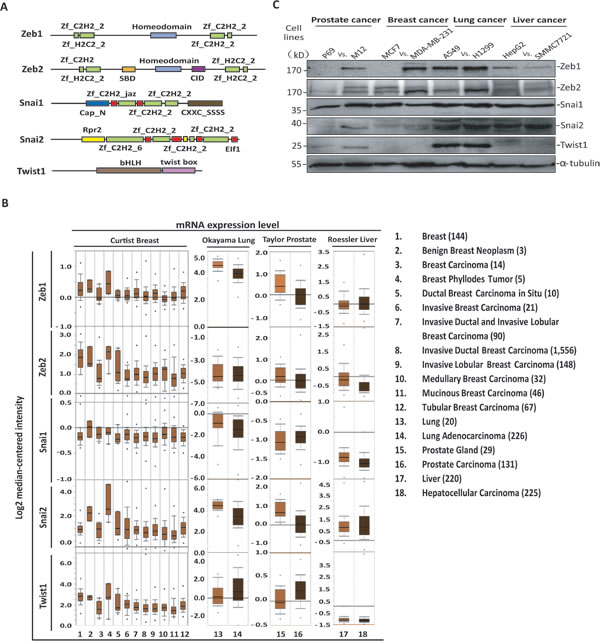 Expression levels of EMT-TFs in tumors and cancer cell lines.