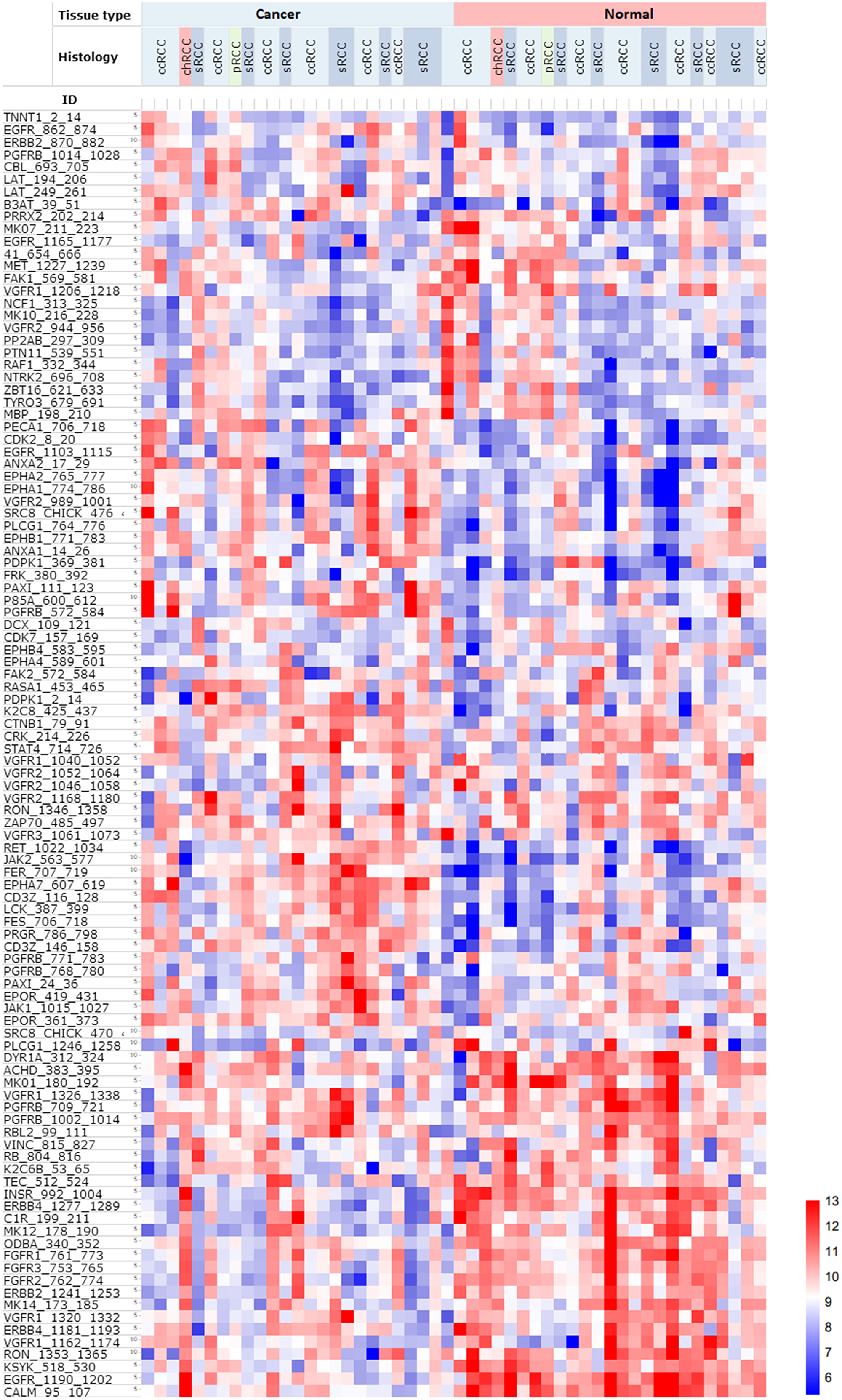 Heatmap of PTK phosphorylation profiles of 25 RCC patients, including malignant and matched normal tissue from the same patient (n = 50).