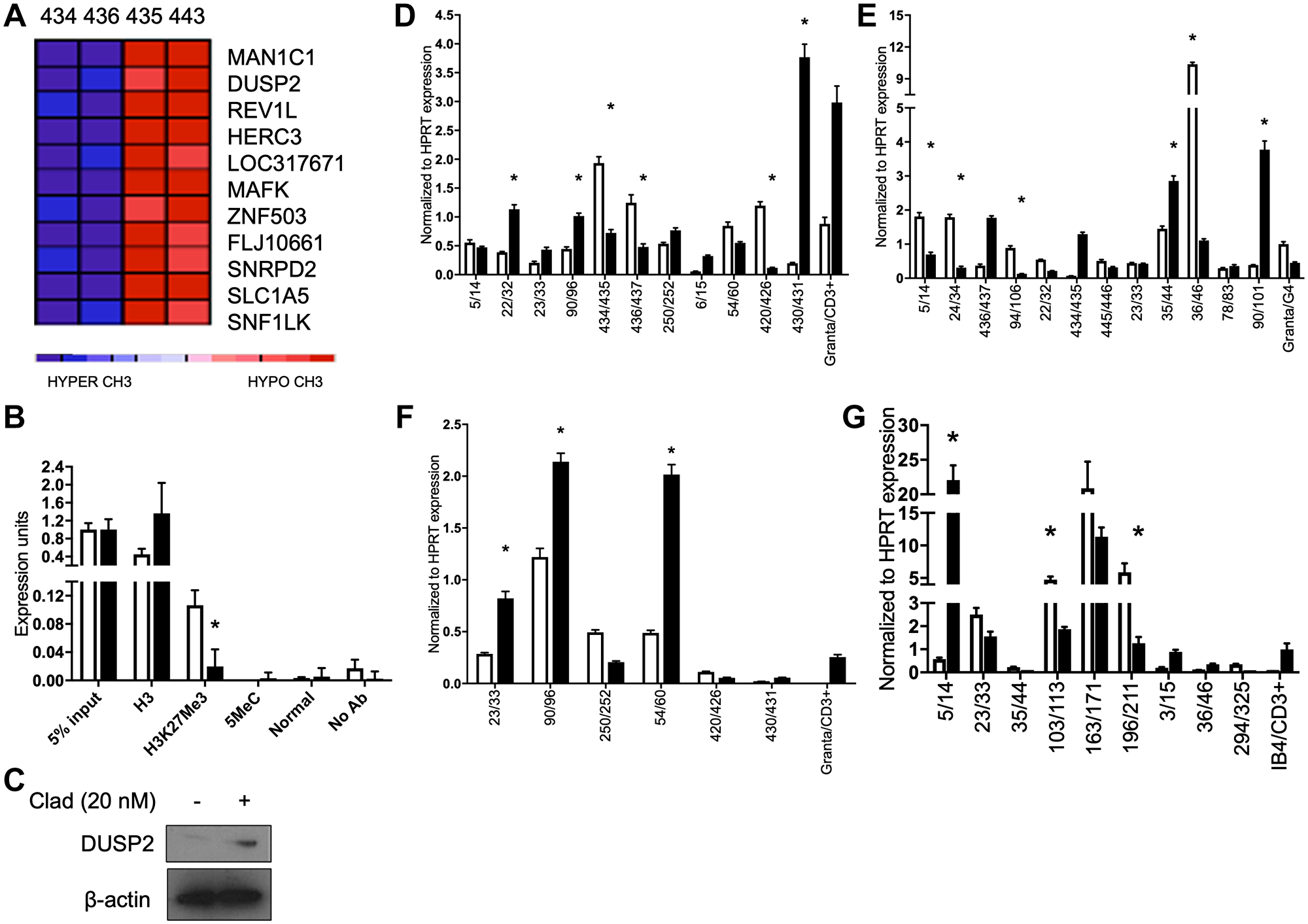 Cladribine derepresses the DUSP2 gene and affects DUSP1, TP53 and CEBPB expression.