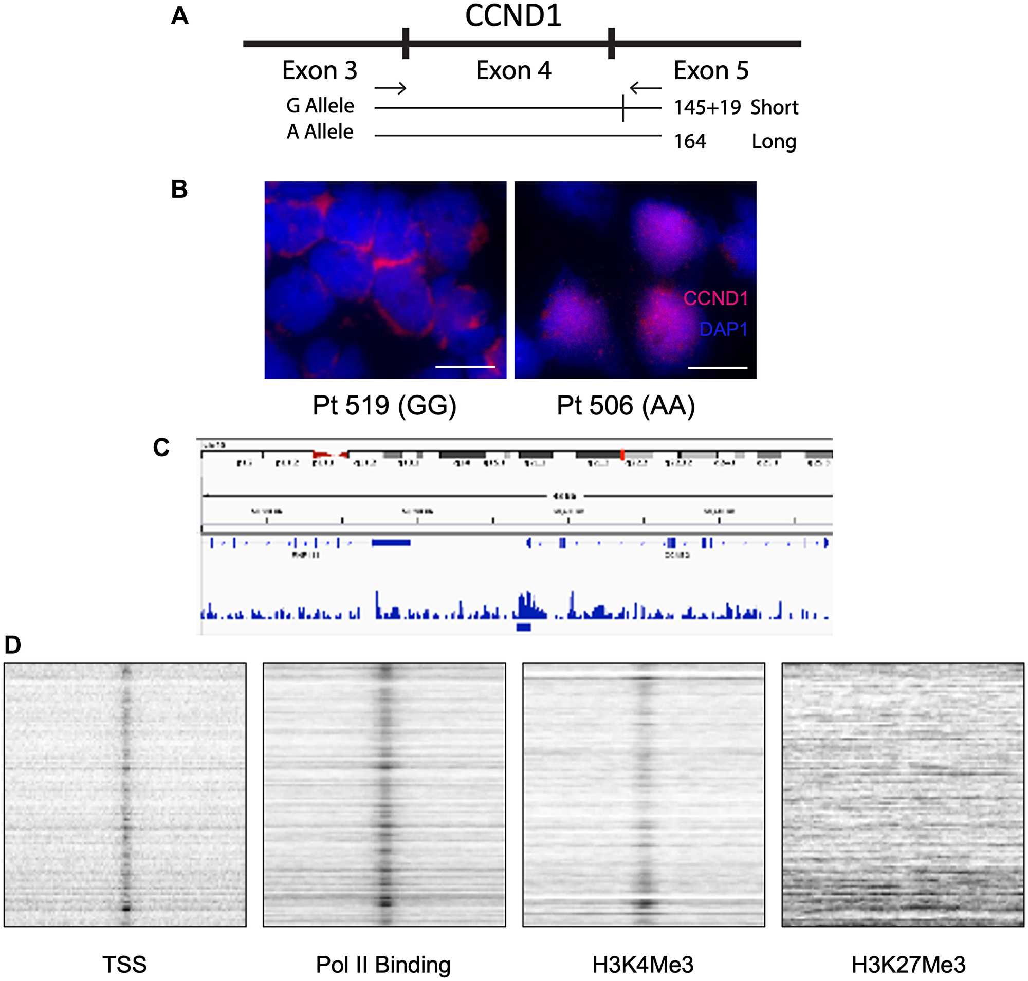 The G/A870 CCND1 polymorphism correlates with cyclin D1 cellular localization and differentiates blastic vs. non-blastic MCL.