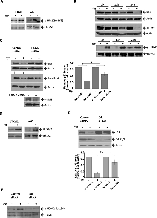 HDM2 regulate p53 in H. pylori-infected cells.