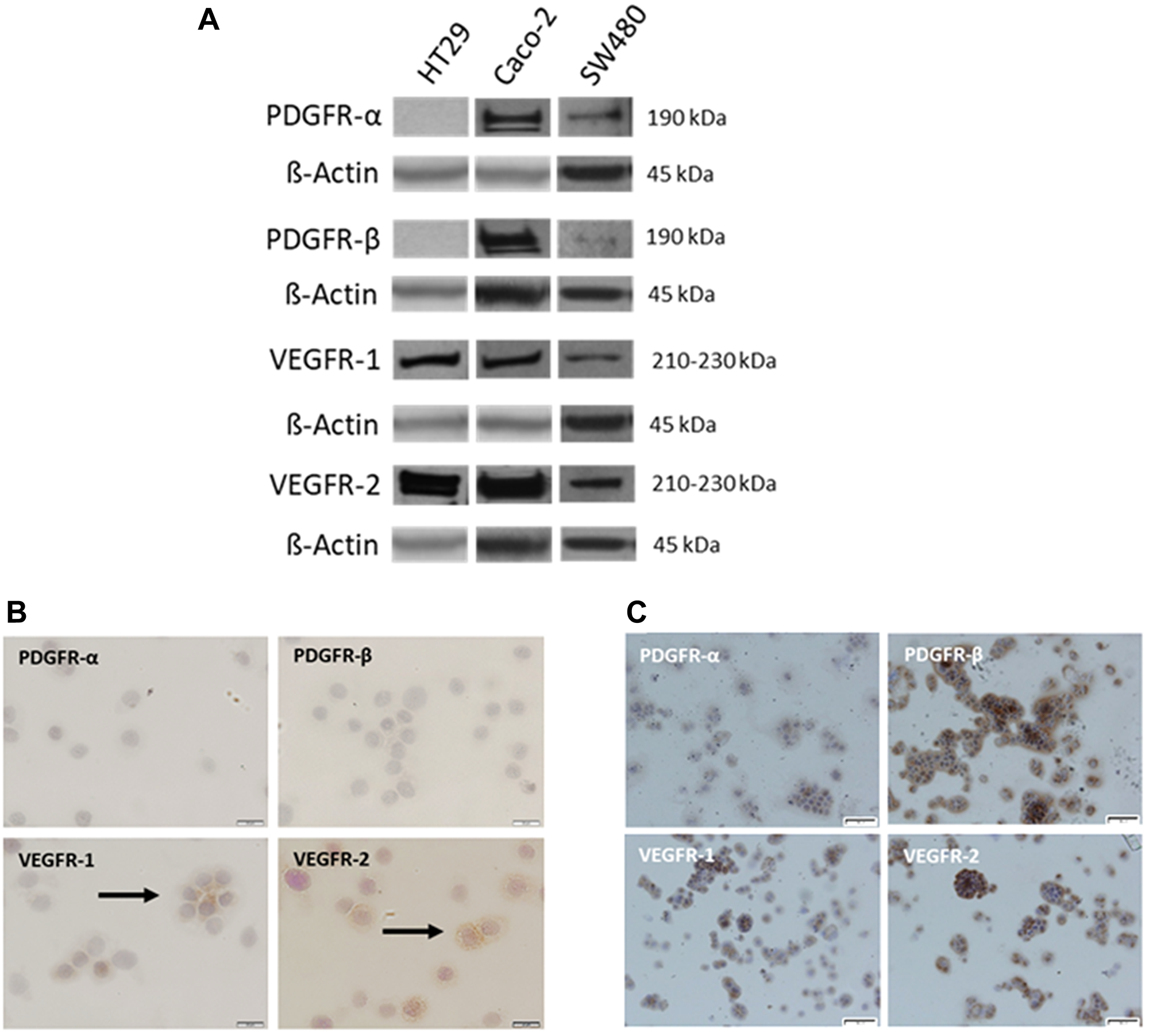 Variable expression of PDGFR and VEGFR in established CRC cell lines.