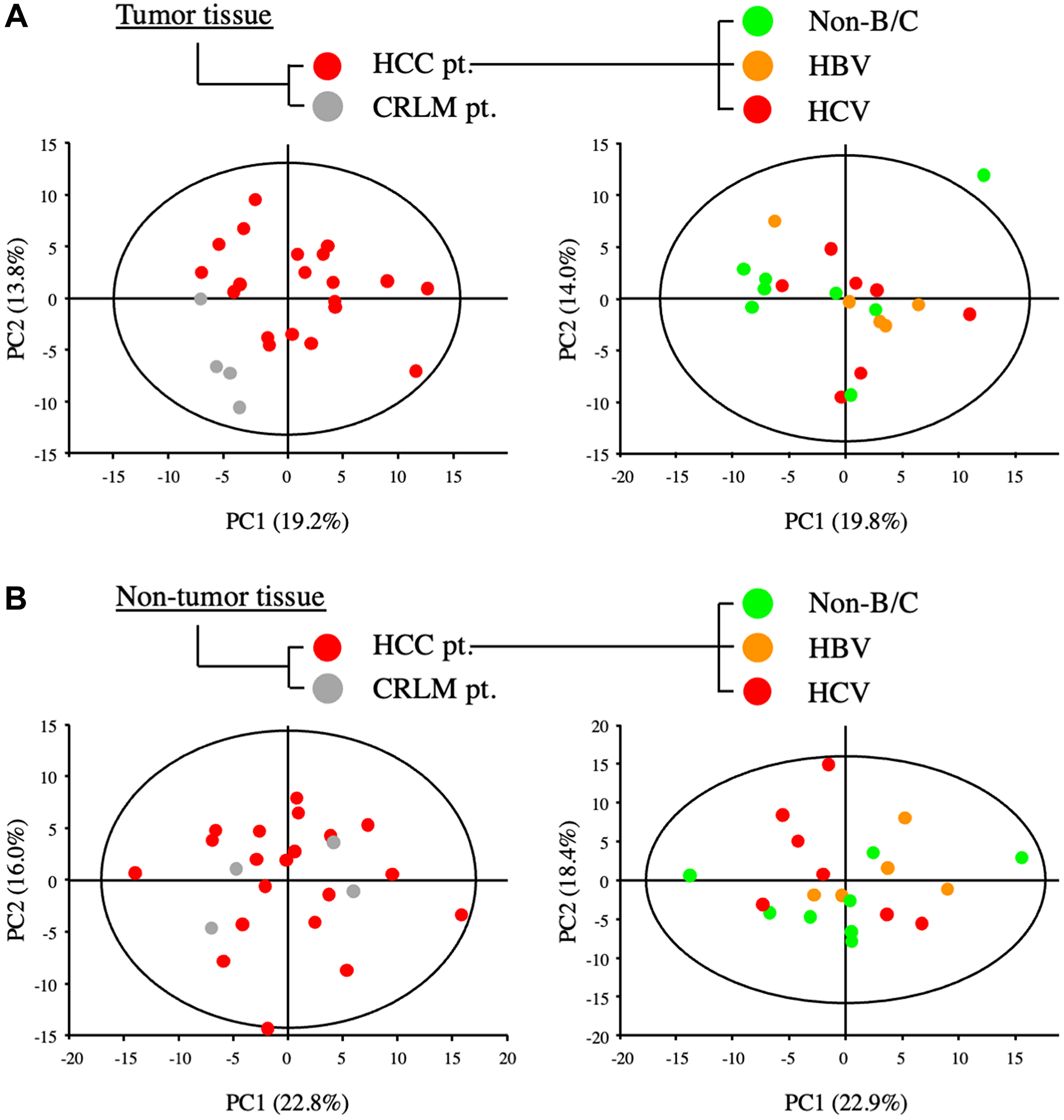 Metabolic analysis of primary and metastatic liver tumors from patients with HCC and colorectal cancer.