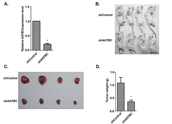 Fig.4: AATBC knockdown inhibited tumorigenesis by bladder cancer cells