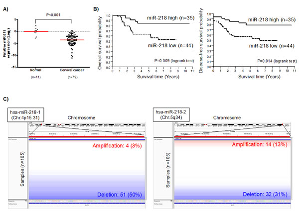 miR-218 down-regulation is associated with poor survival in cervical cancer patients.