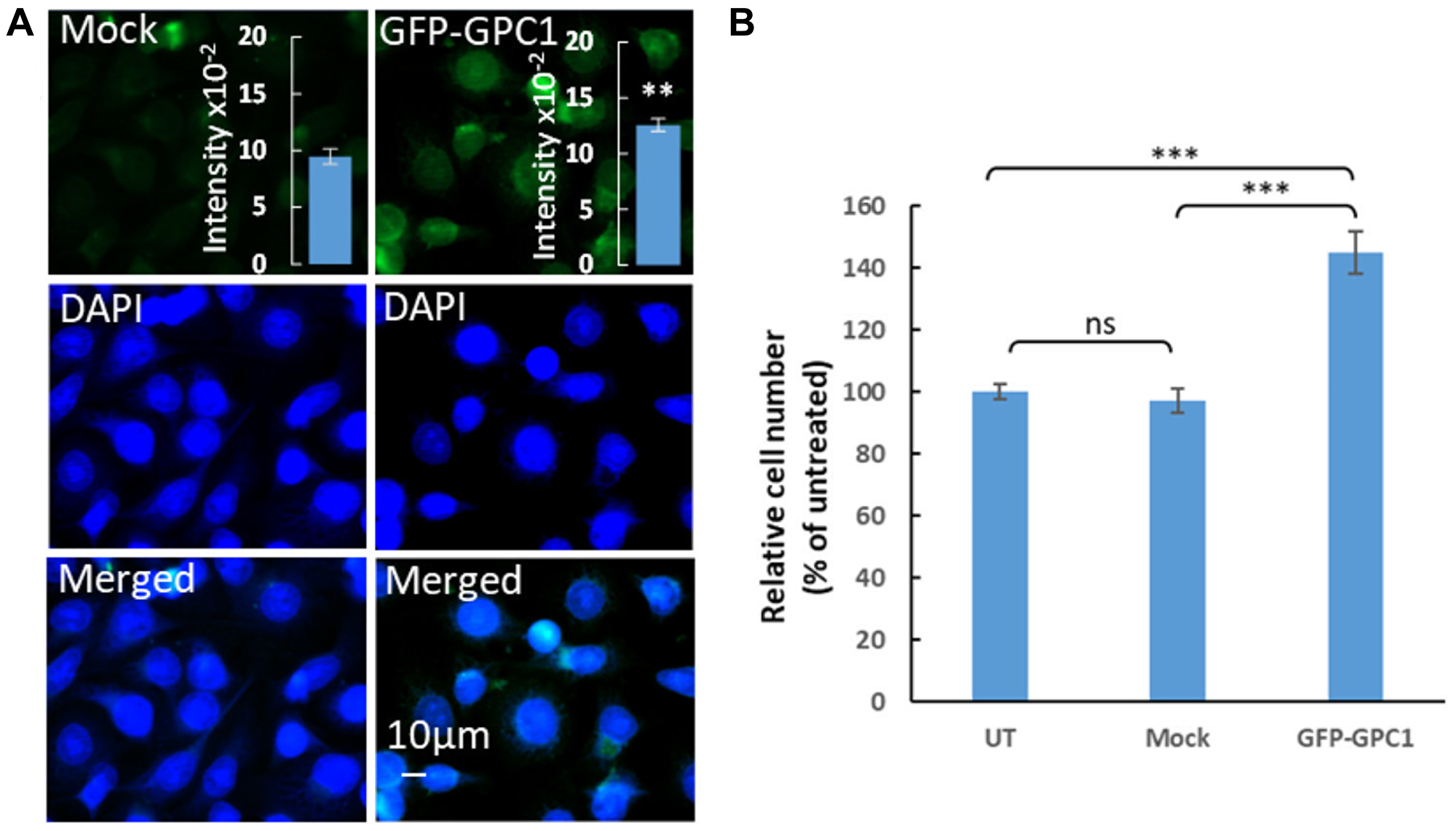 Overexpression of GPC1 increases proliferation of T24 cells.