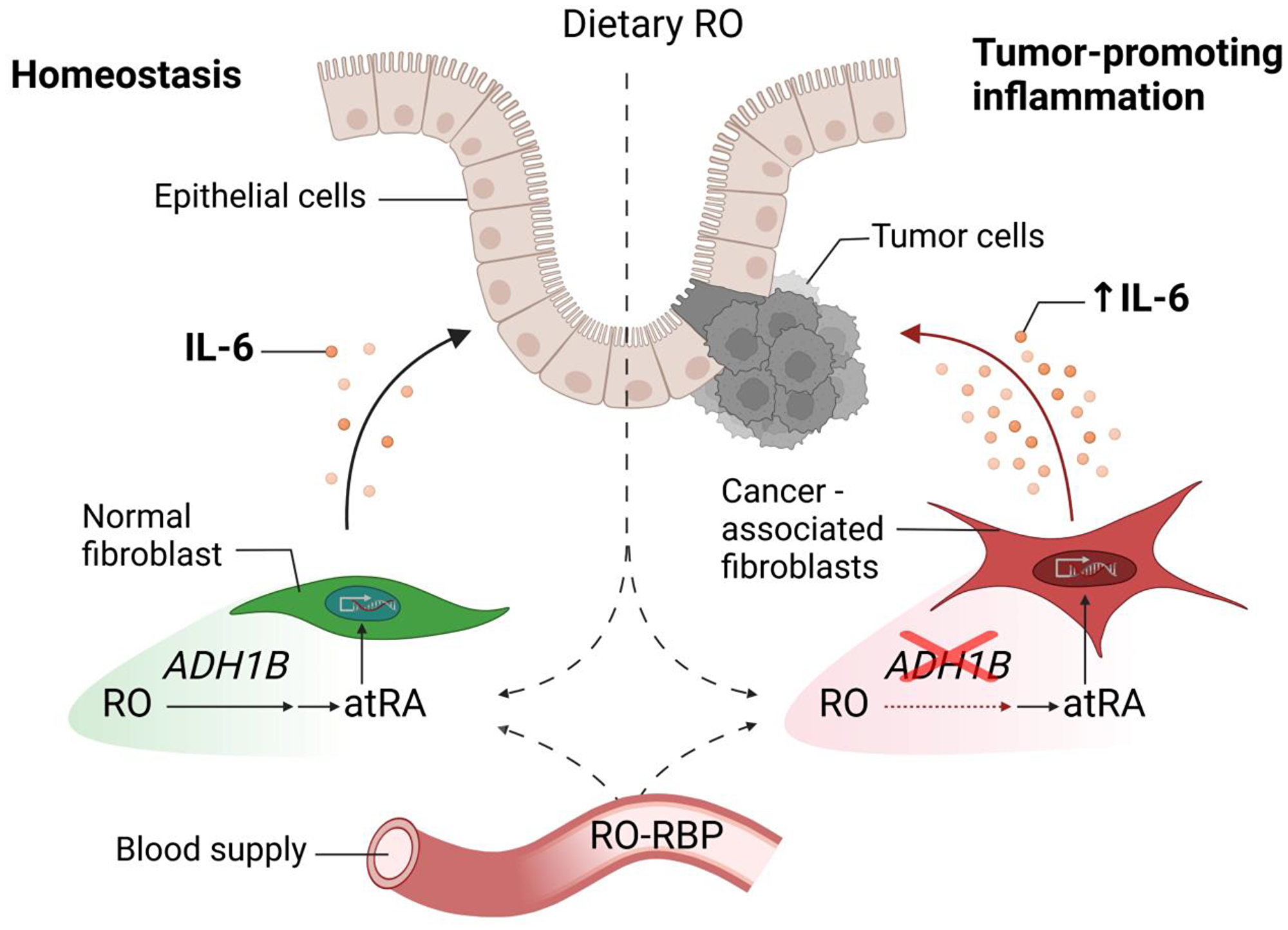 Retinol-mediated suppression of tumor-promoting IL-6 is disrupted in colon cancer-associated fibroblasts.
