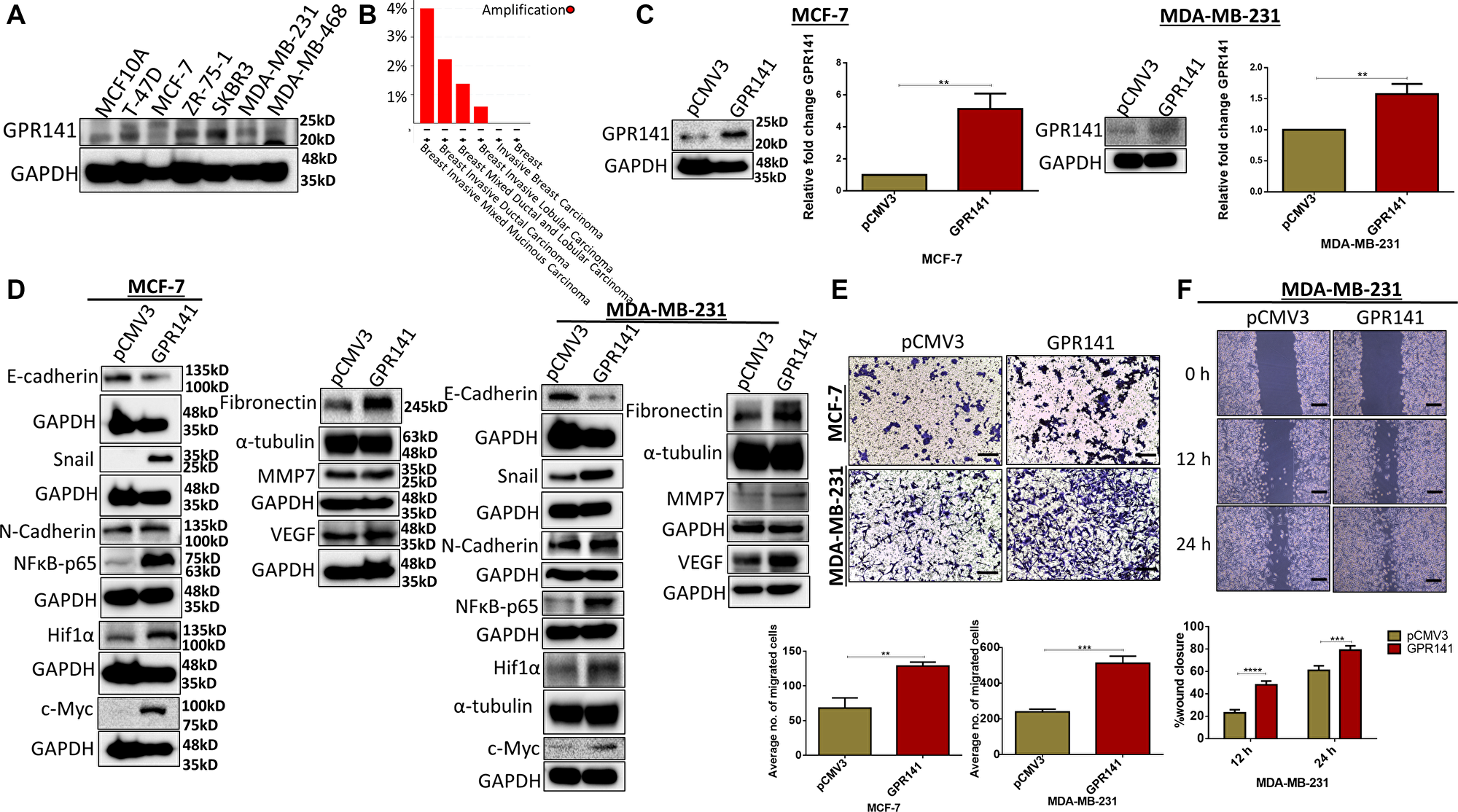 GPR141 overexpression in breast carcinoma induces the expression level of oncogenic mediators and EMT markers and influences tumor niche in vitro.