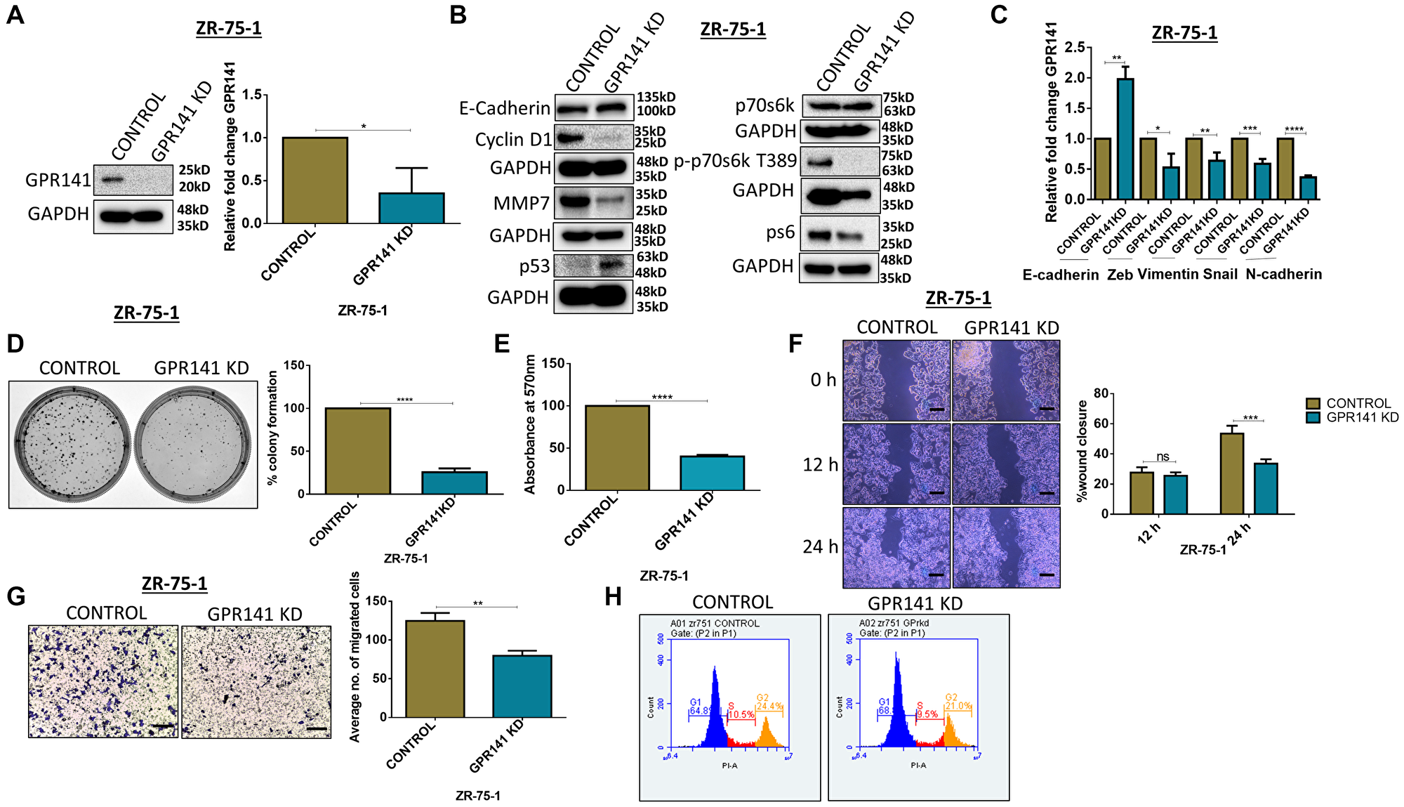 GPR141 silencing suppresses migration of breast cancer cells and tumorigenesis in vitro.