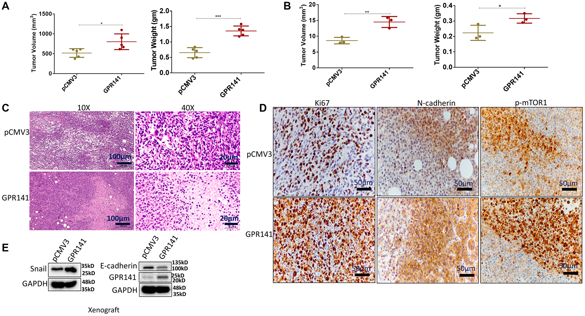 GPR141 overexpression in breast cancer cells increases their propensity to form tumors in female NOD SCID mouse and chick CAM models and modulates the tumor microenvironment in vivo.