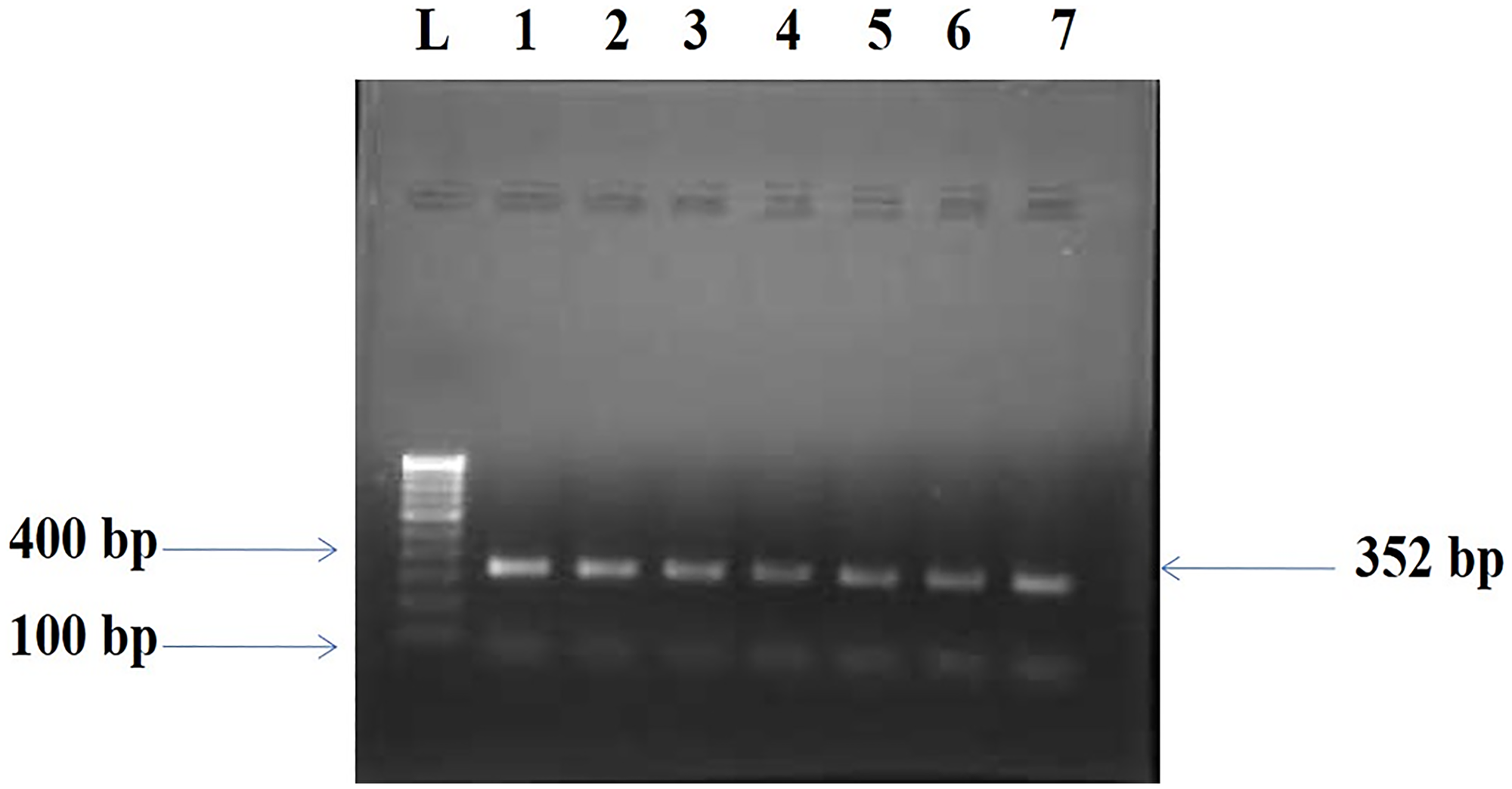 Amplified PCR product 352 bp of BORIS gene.