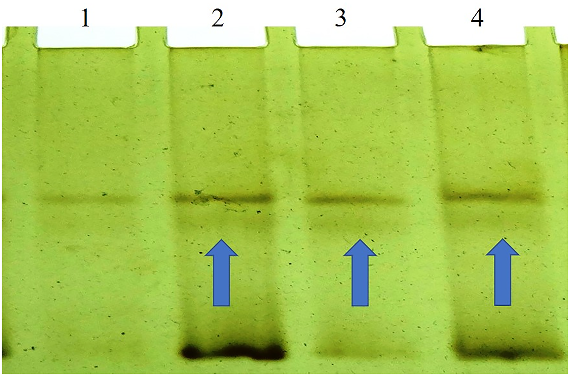 SSCP (non-radio-active) analysis of the BORIS gene which shows a variation or shifts in the band at Lane 2, 3, and 4 of the breast tumor samples.