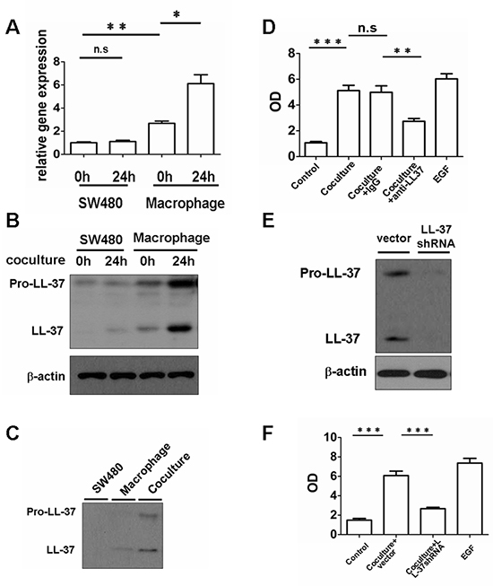 Macrophage-derived cathelicidin accelerates growth of colon cancer cells in vitro.