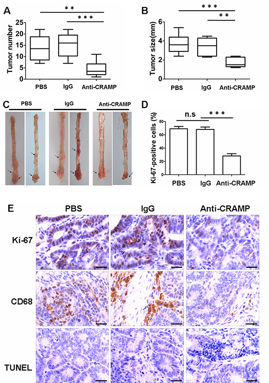 Neutralization of cathelicidin reduces colon tumor growth.