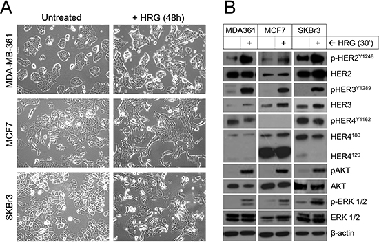 Treatment of luminal HER2+ breast cancer cell lines with exogenous HRG alters cell morphology and activates signaling through HER2, HER3, AKT and ERK.