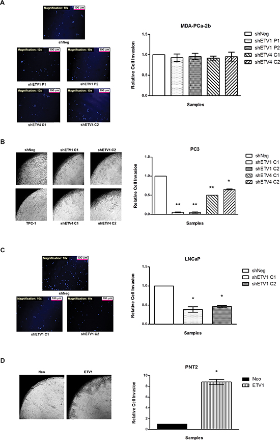 In vitro evaluation of the impact of ETV1 or ETV4 silencing in cell invasion.