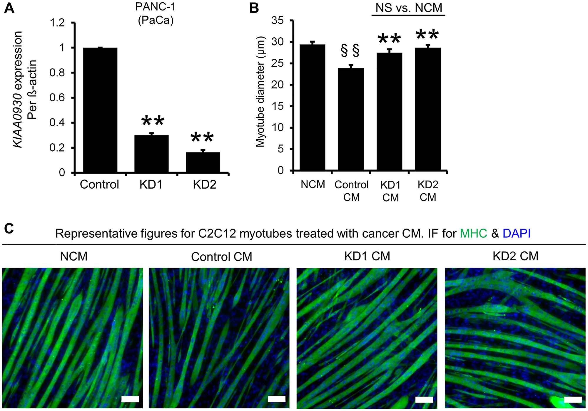 ShRNAs targeting KIAA0930 decrease KIAA0930 mRNA expression and suppress muscle atrophy in PANC-1 cells in vitro.