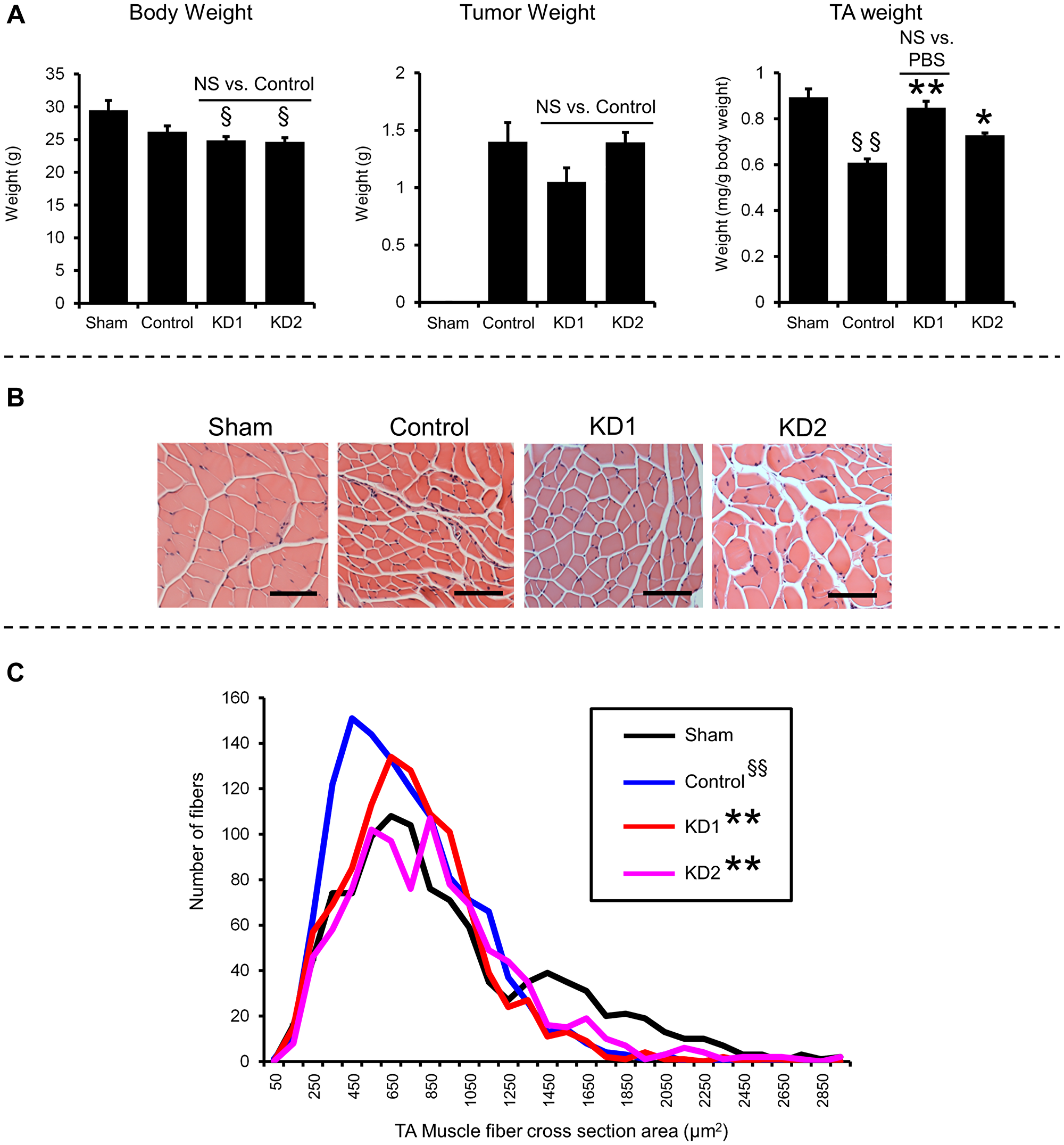 KIAA0930 knockdown alleviates muscle atrophy in a PANC-1 orthotopic xenograft model.