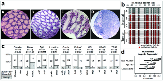 ADAMTS14 methylation and genotype/phenotype of CRC without MSI.