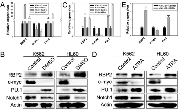 RBP2 induces cell differentiation.