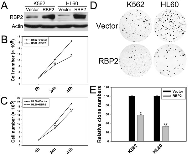 RBP2 inhibits the cell proliferation.